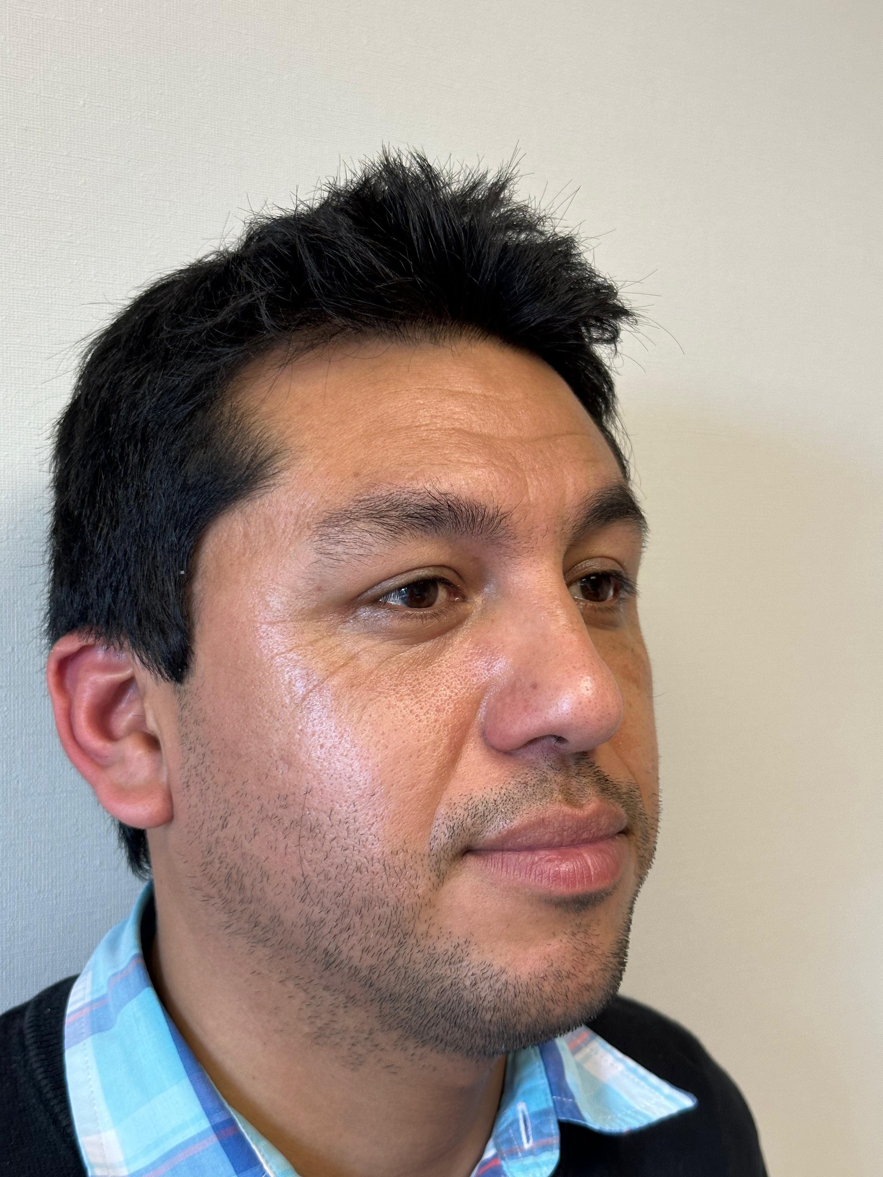 Resultado capilar paciente