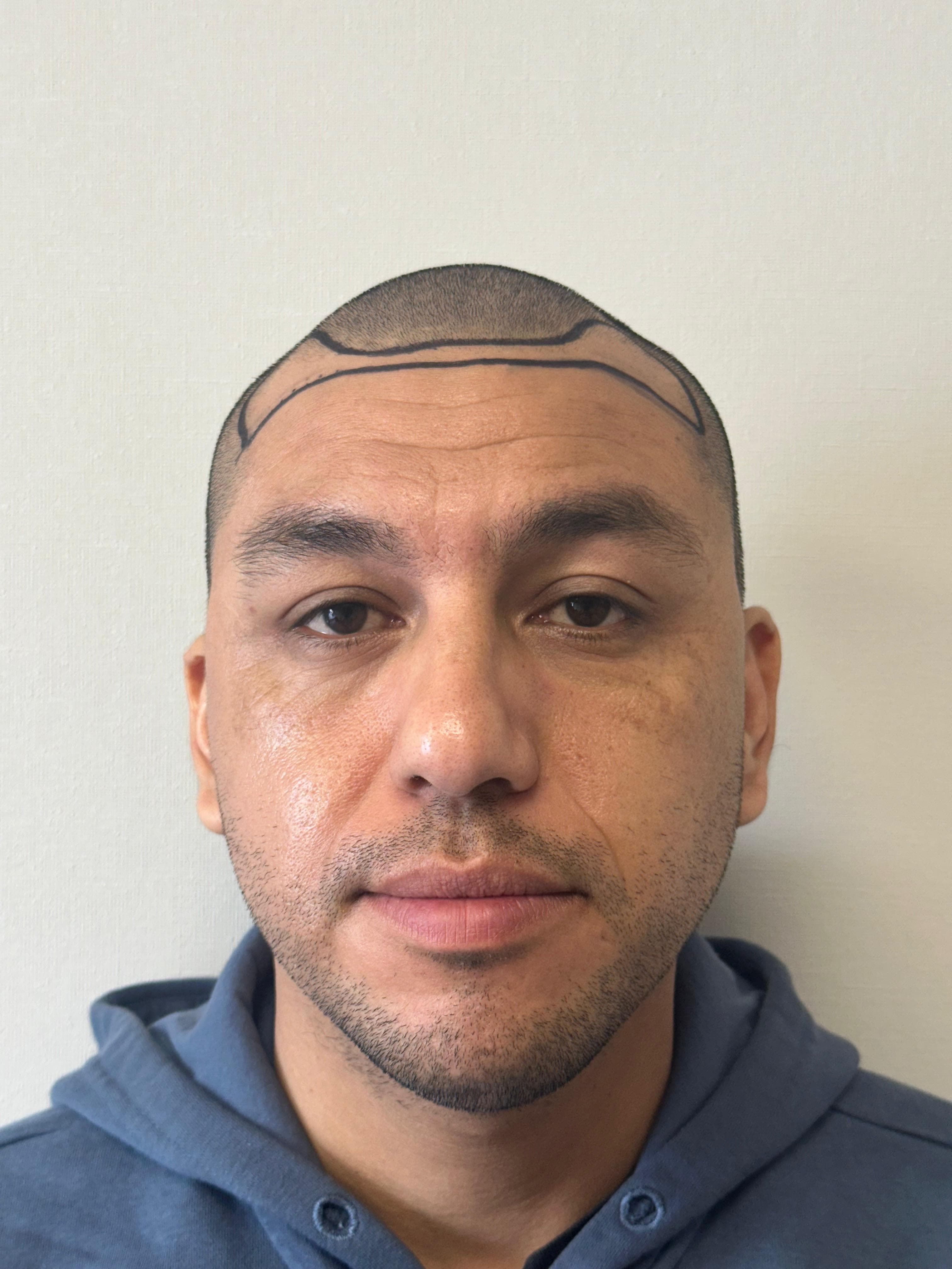 Evolución tratamiento