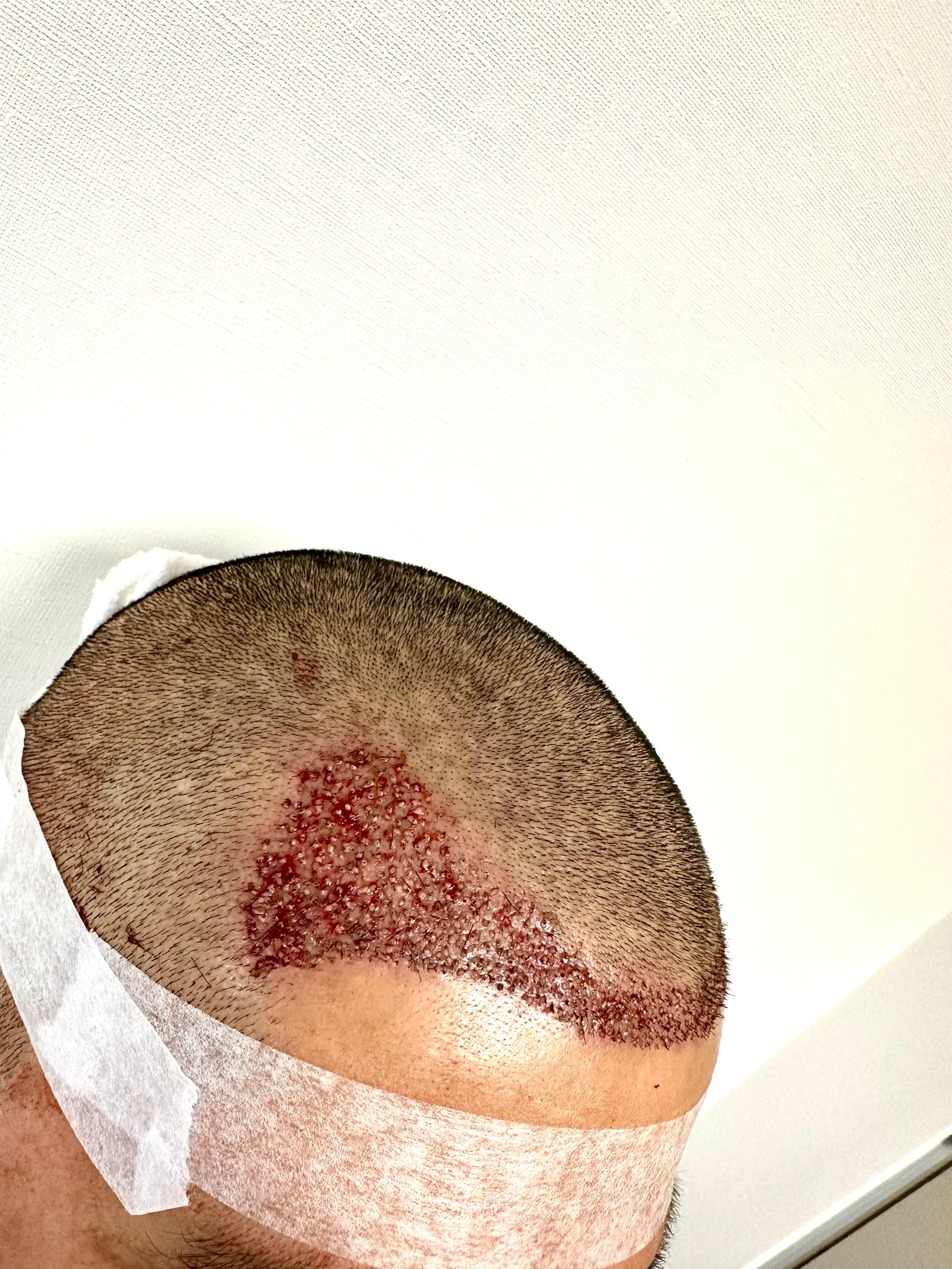 Resultado caso clínico