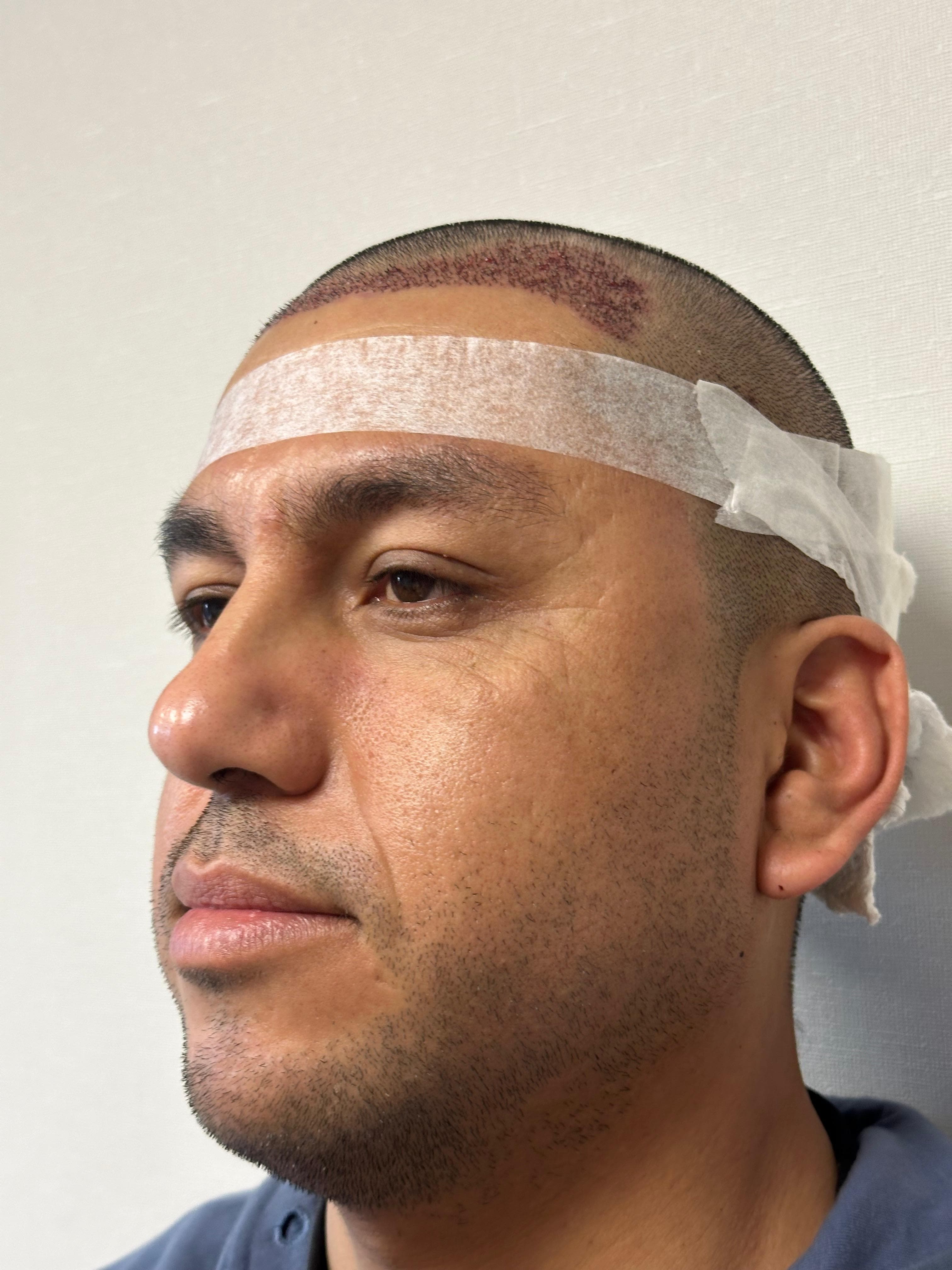 Seguimiento resultado