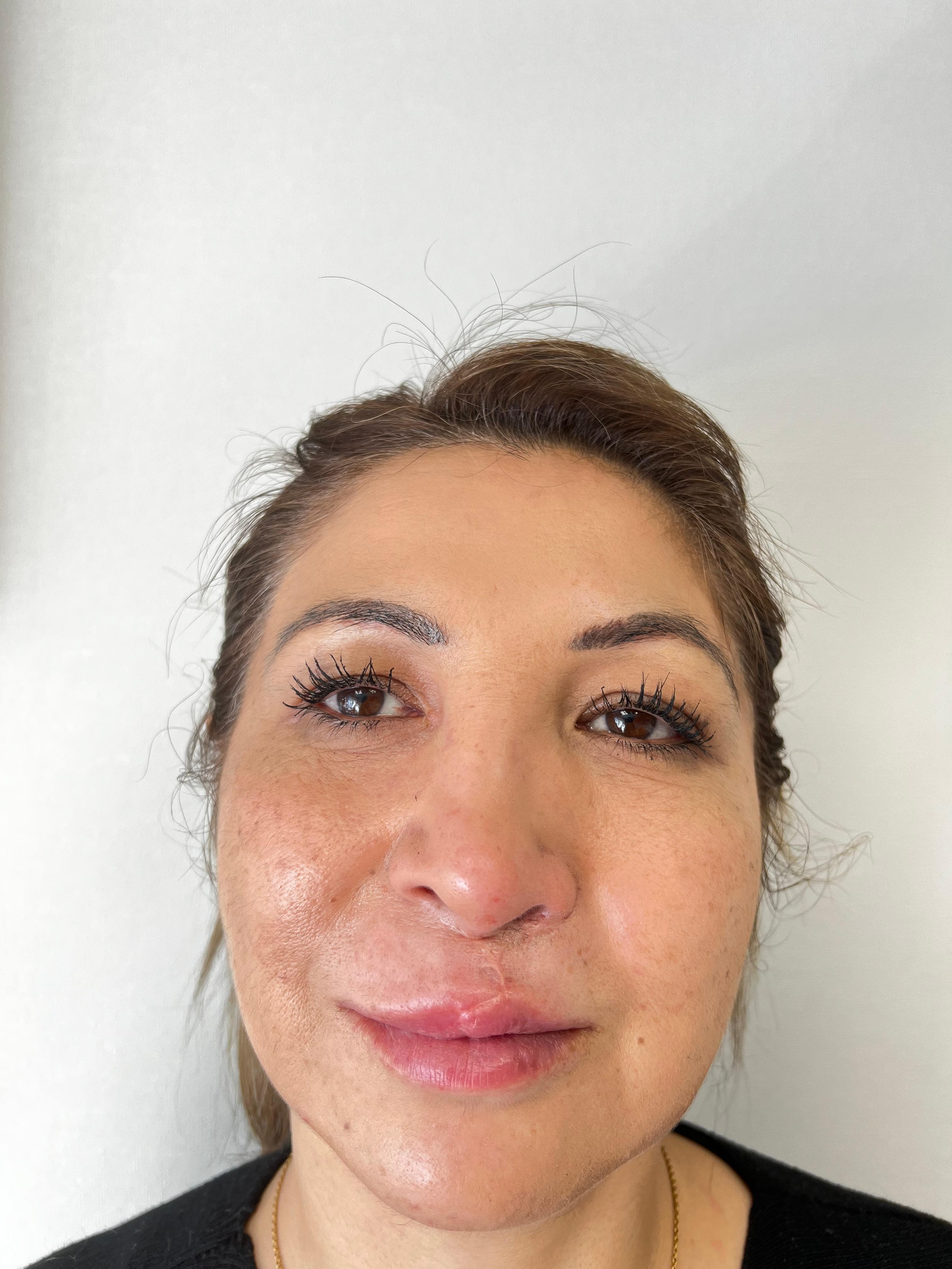 Antes y después estética