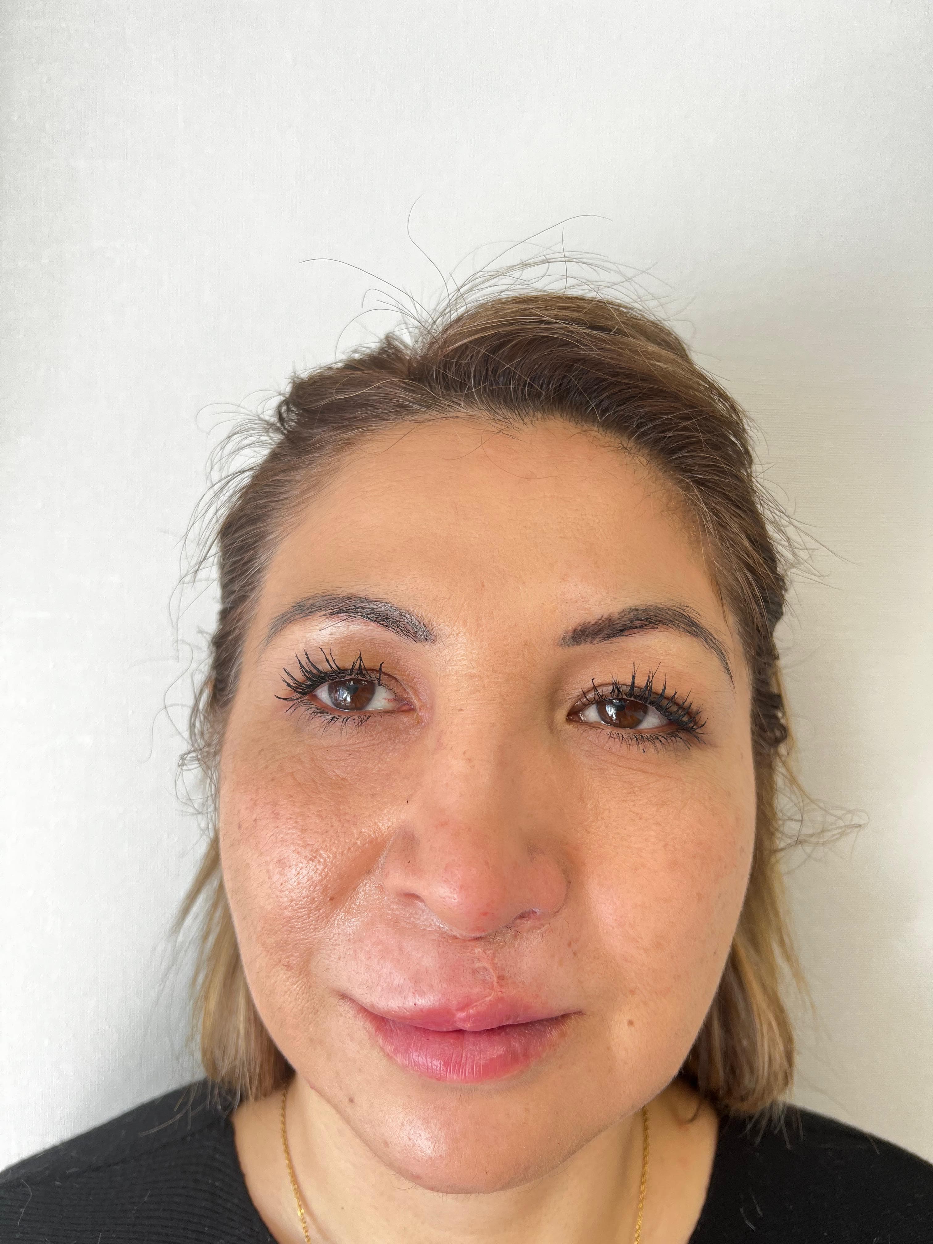 Resultado estético paciente