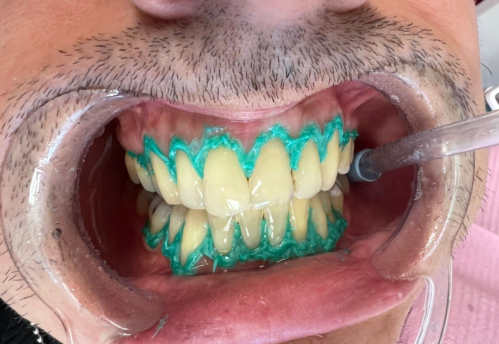 Odontología e Implantología