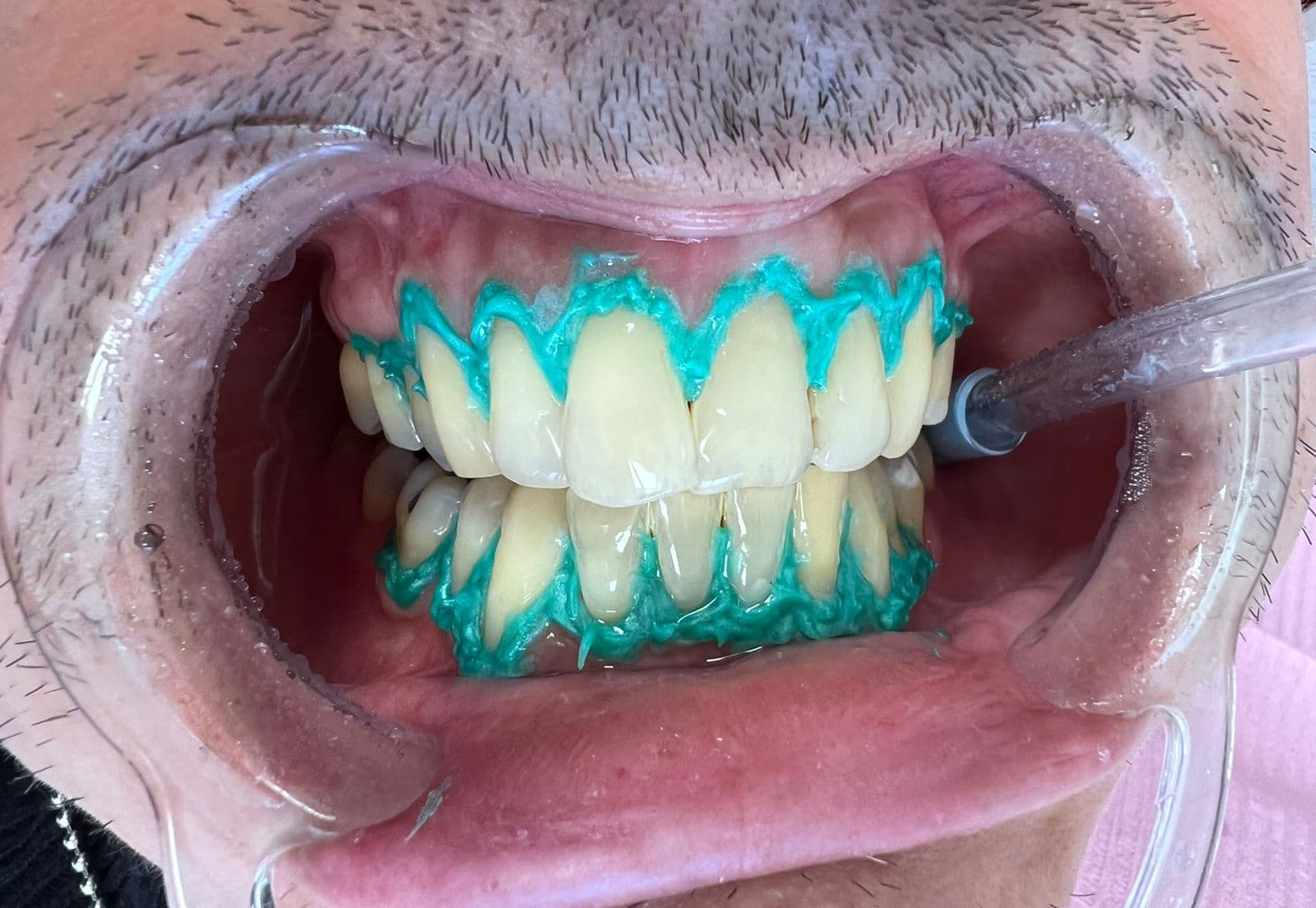 Caso odontológico 2