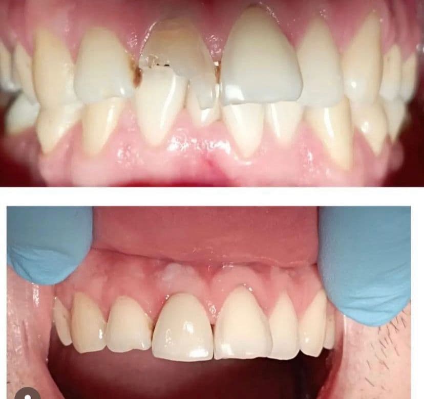 Caso clínico dental