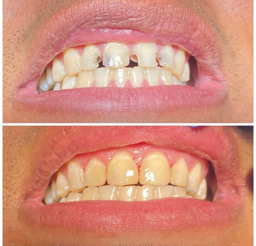 Rehabilitación oral