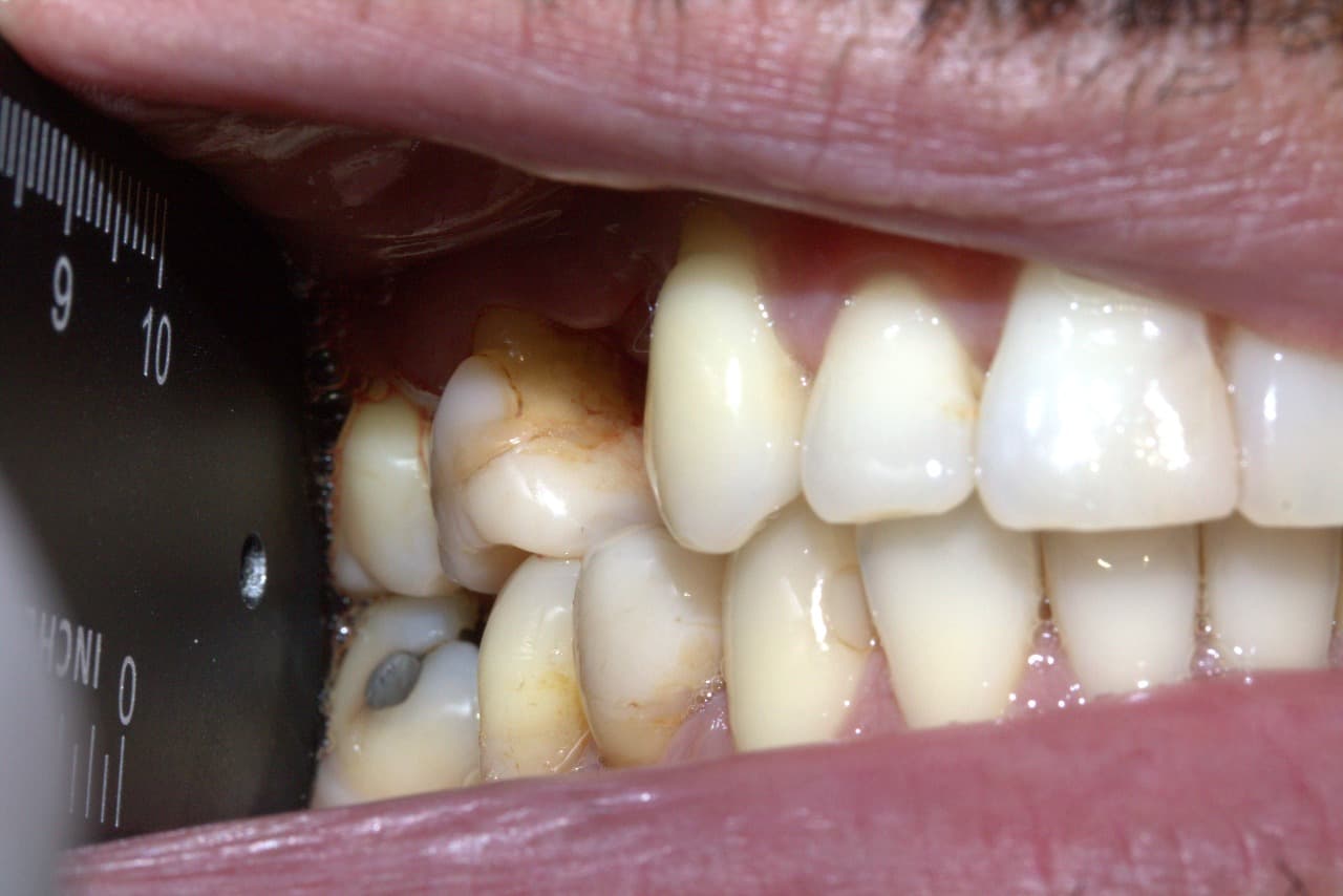 Resultado ortodoncia