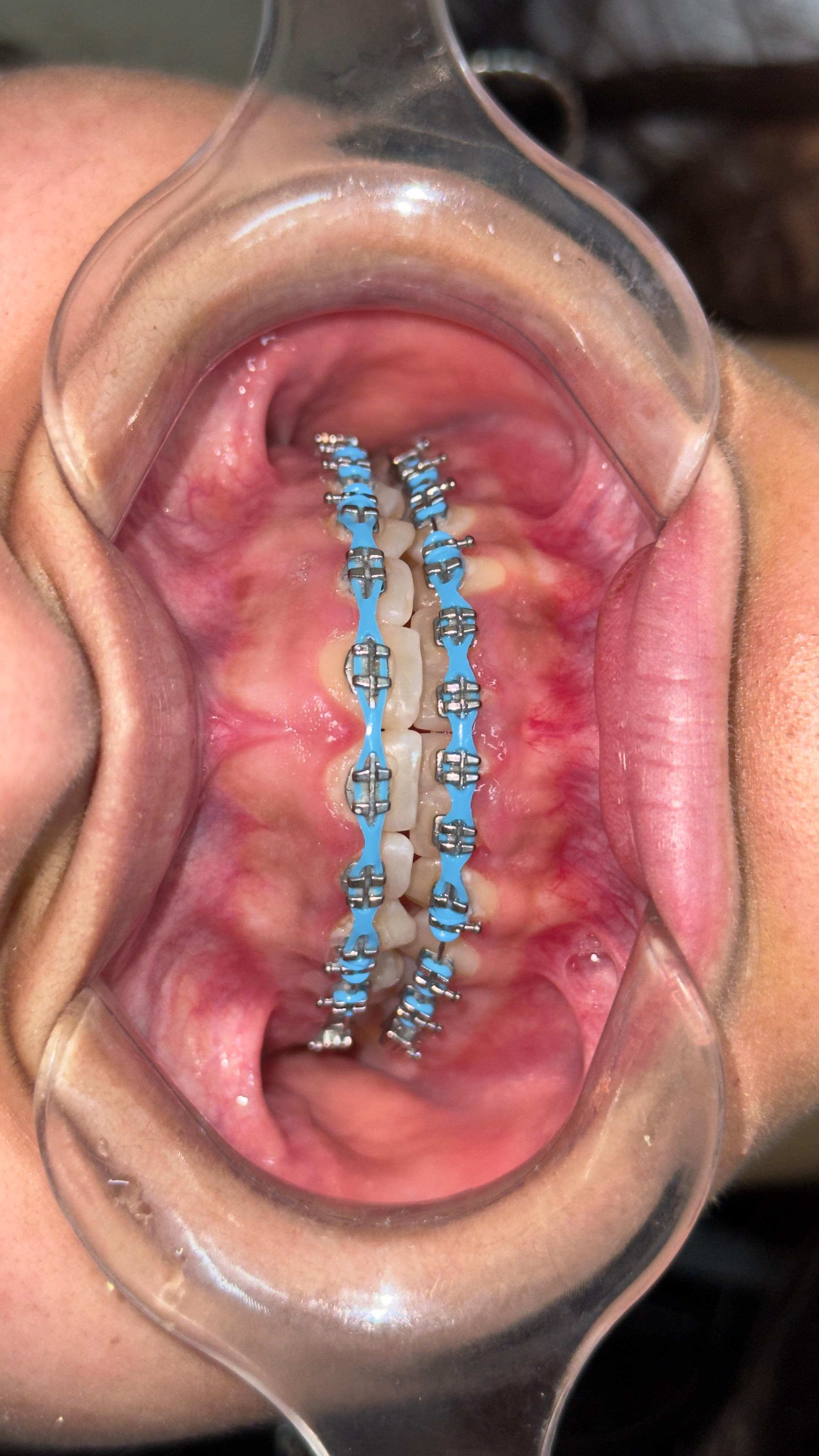 Caso clínico reciente