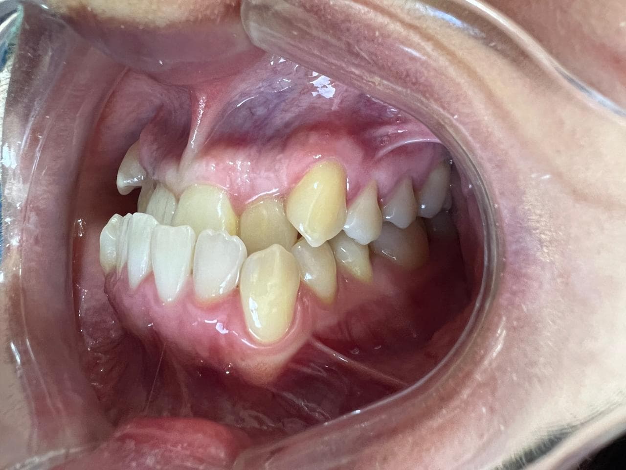 Transformación dental