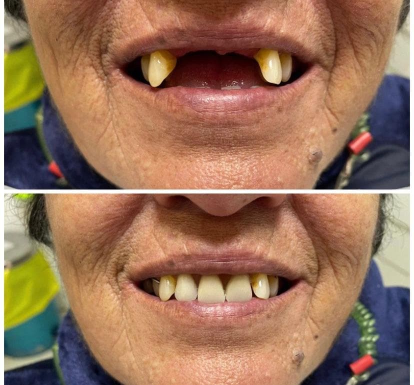 Higiene dental: lo que si funciona para prevenir urgencias